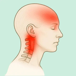 Emicrania di Origine Cervicale